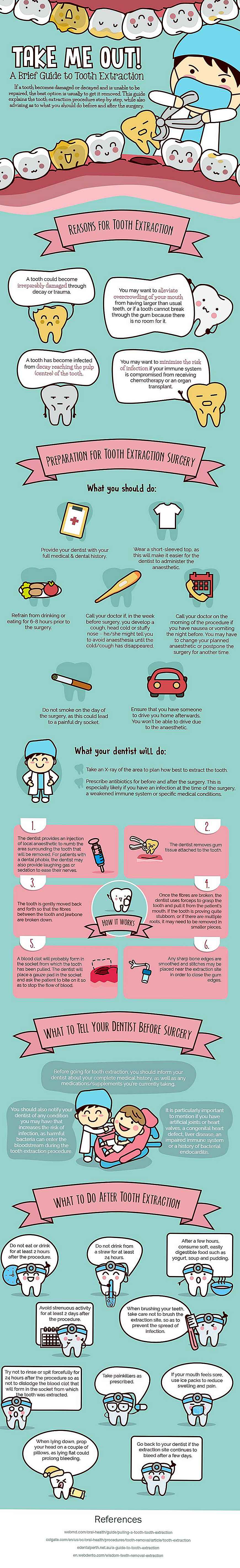 Infografica: Take Me Out: una breve guida all'estrazione del dente