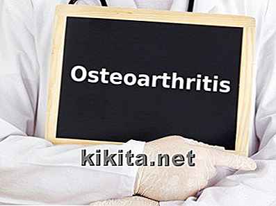 6 caratteristiche disarticolate di osteoartrite e artrite reumatoide